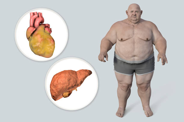 Reversing Fatty Liver Disease with Diet: 3 Essential Foods for Liver Health in 2024