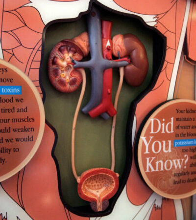 Essential Practices for Kidney Health: What to Avoid to Protect Your Kidneys